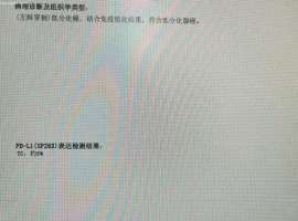 经过7天的等待时间 基因报告出来了
