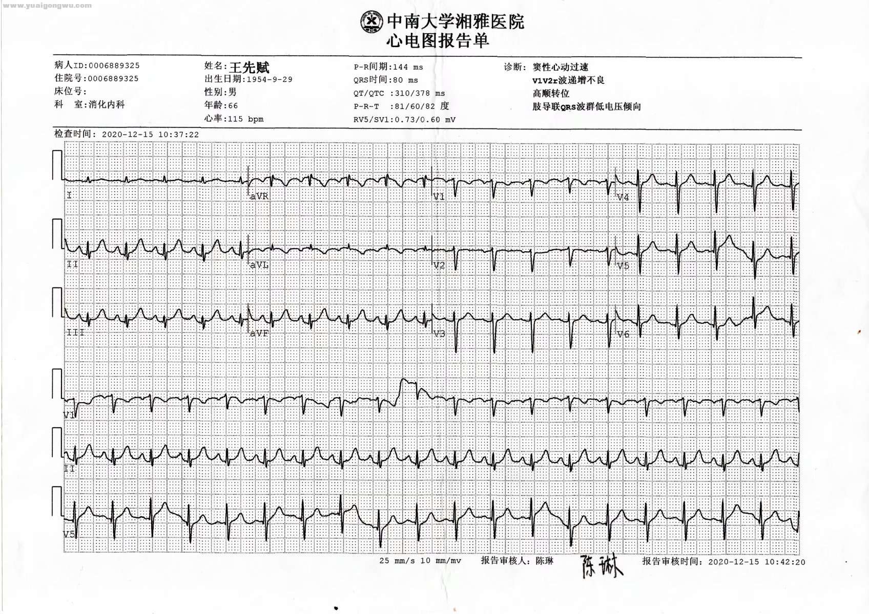 湘雅复查（心电图）.jpg