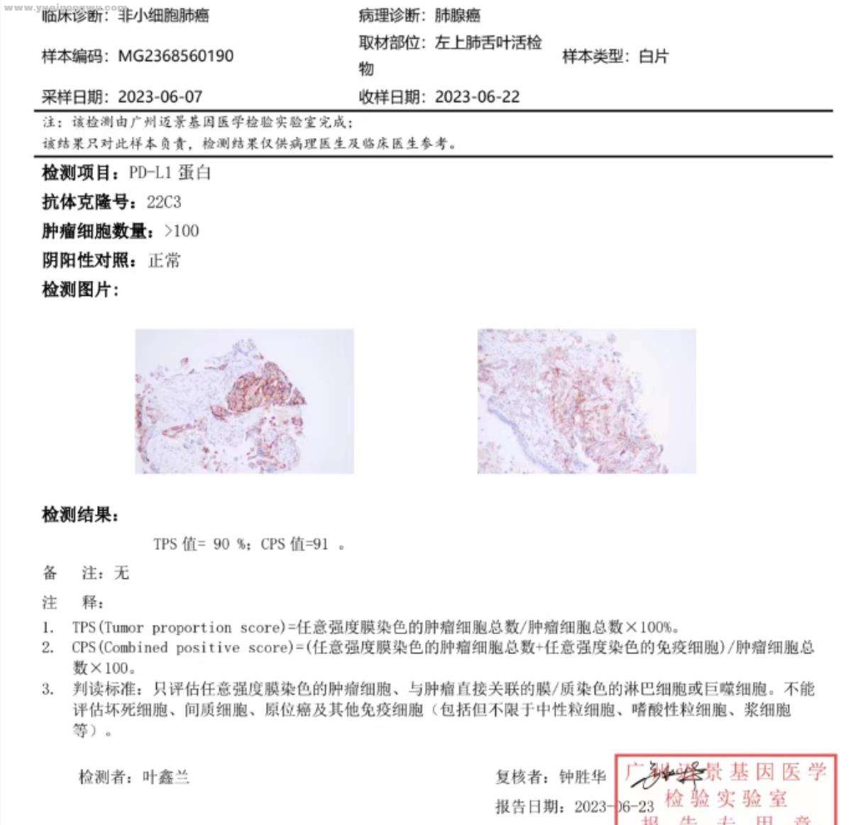 PD-1免疫组化检测报告.jpg